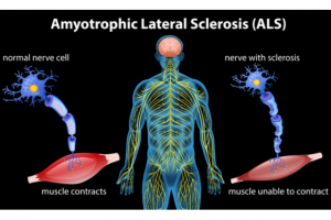 Illustration shows the human central nervous system, & nerve cells' interaction w/ muscles